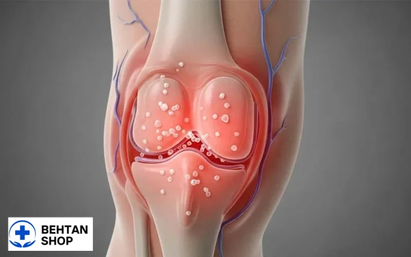 زانو درد در اثر نقرص | بهتن شاپ