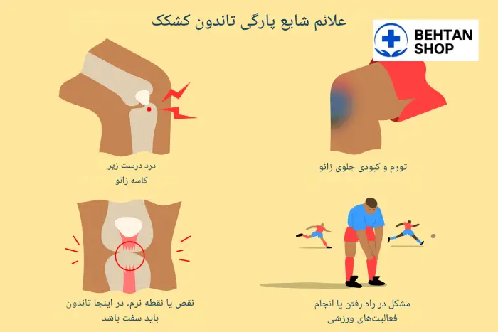 علائم کشیدگی تاندون زانو (1)
