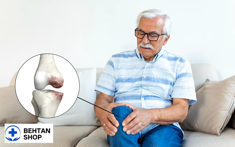 آرتروسکوپی زانو برای آرتروز خفیف زانو | بهتن شاپ