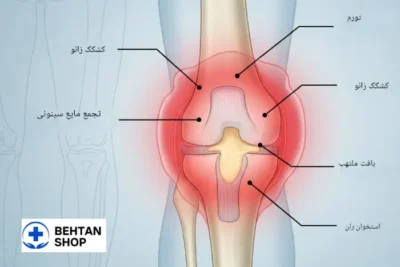 آب آوردن زانو