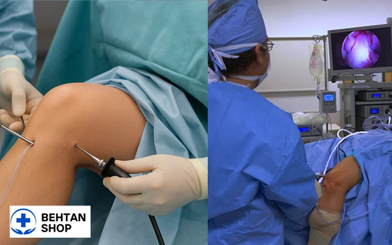 آرتروسکوپی زانو | بهتن شاپ