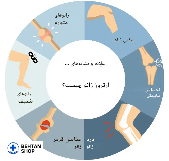 علائم آرتروز زانو