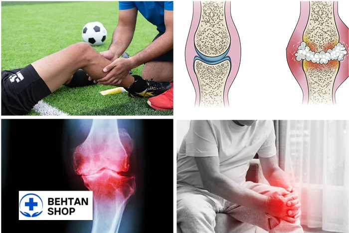 علل افیوژن زانو | بهتن شاپ