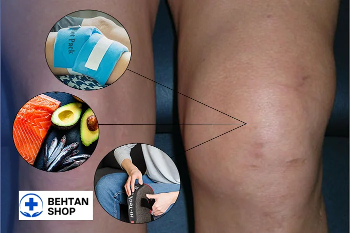 درمان خانگی افیوژن زانو | بهتن شاپ