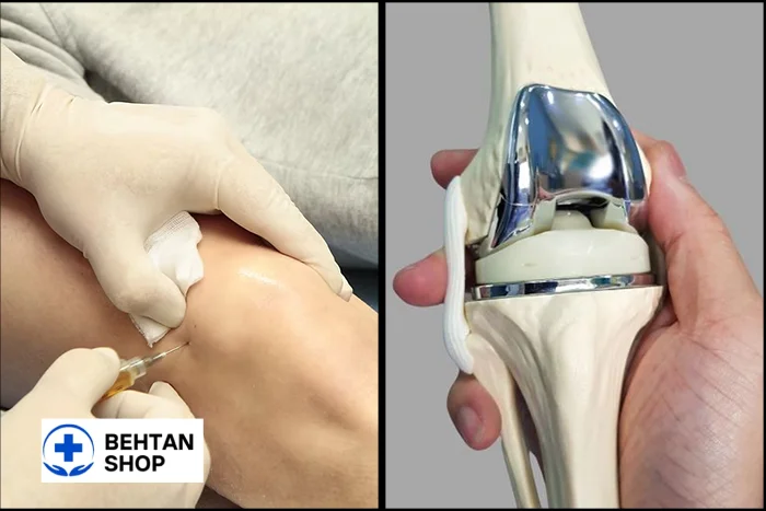 جراحی مفصل زانو | بهتن شاپ