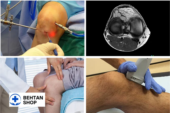 تشخیص کیست زانو | بهتن شاپ