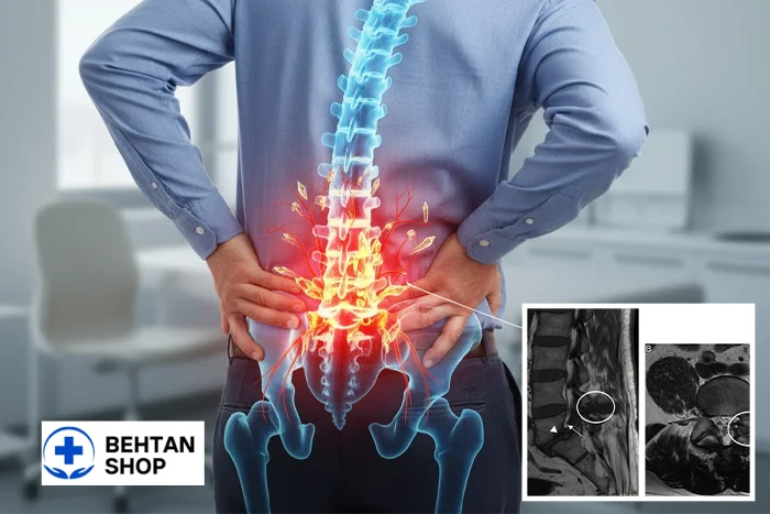 عوارض پای مرغ | بهتن شاپ