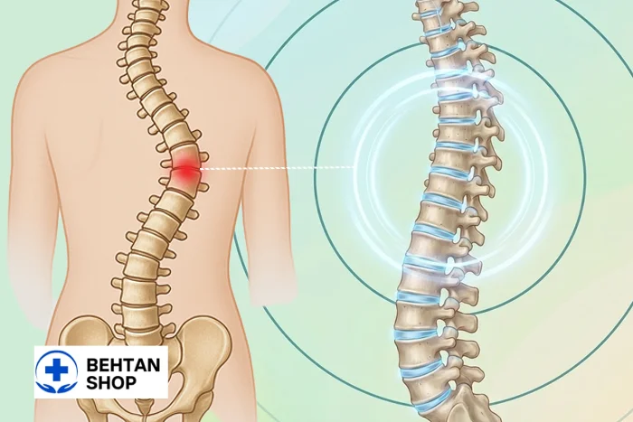 انحراف ستون فقرات | بهتن شاپ