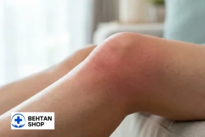 بورسیت زانو| بهتن شاپ