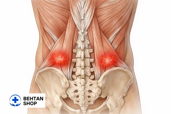 گرفتگی عضلات کمر چیست؟ | بهتن شاپ