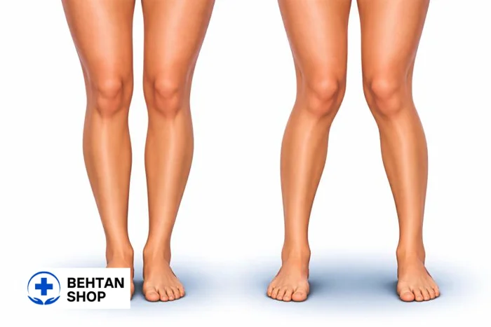 زانوی ضربدری | بهتن شاپ