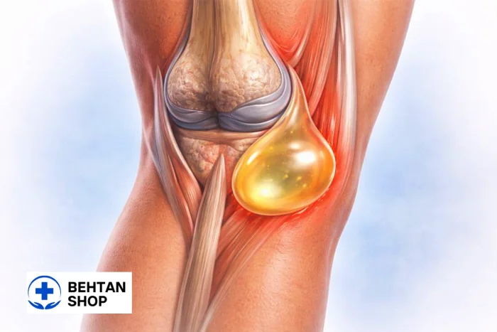 کیست بیکر | بهتن شاپ